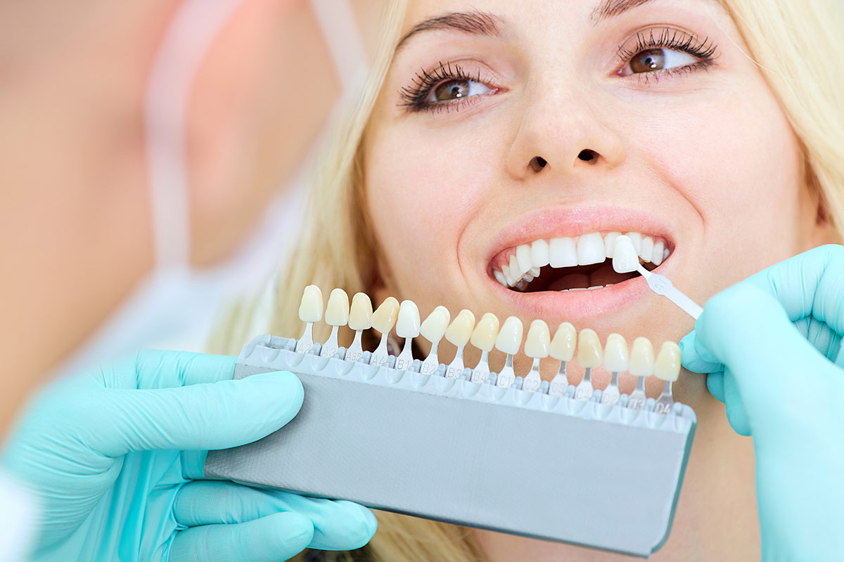Lente de contato, faceta ou coroa: qual é melhor na estética dental?