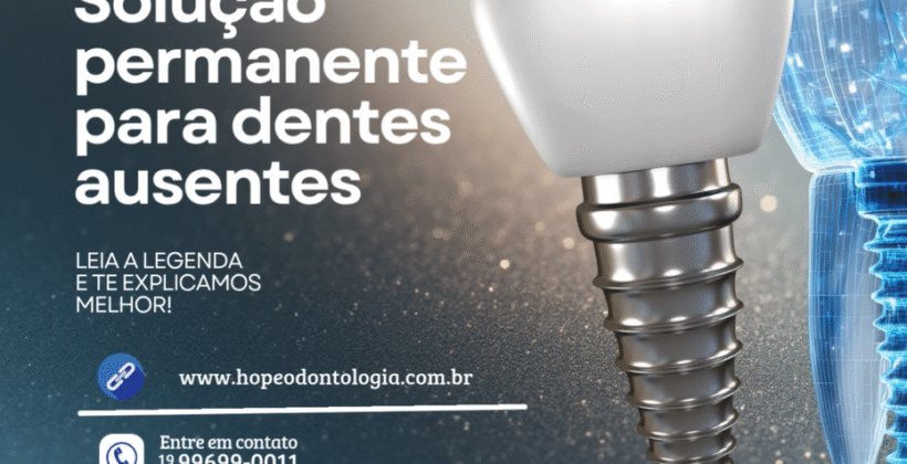 SOLUÇÃO PARA DENTES AUSENTES