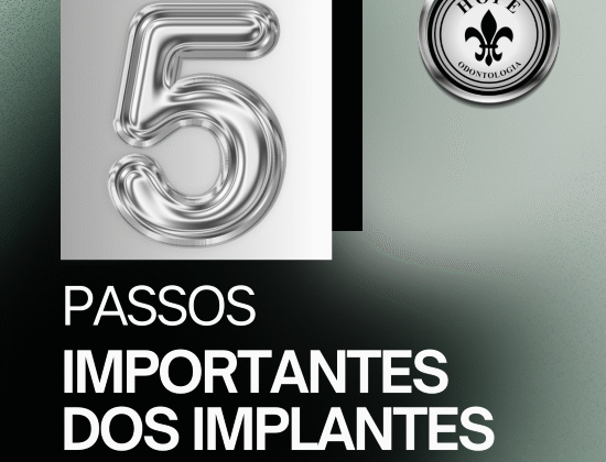 PASSOS IMPORTANTES DO IMPLANTE DENTAL