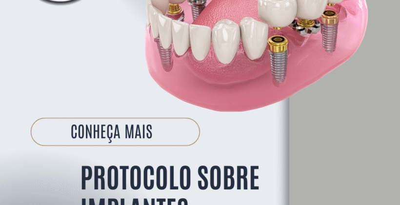 PROTOCOLO DE IMPLANTES PROTOCOLO DE IMPLANTES