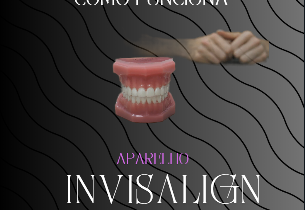 COMO FUNCIONA O INVISALIGN?