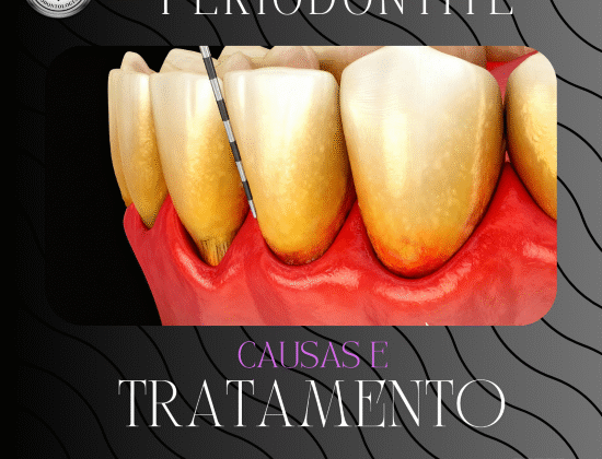 PERIODONTITE CAUSAS E TRATAMENTO