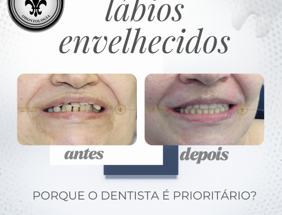 LÁBIOS ENVELHECIDOS