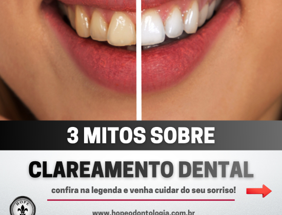 CLAREAMENTO DENTAL