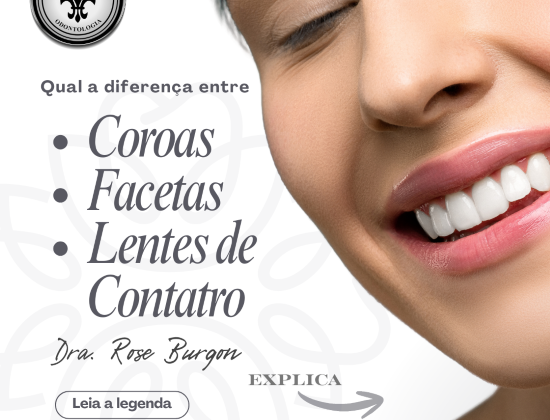 COROAS – FACETAS – LENTES DE CONTATO