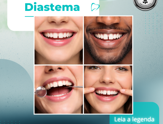 DIASTEMA