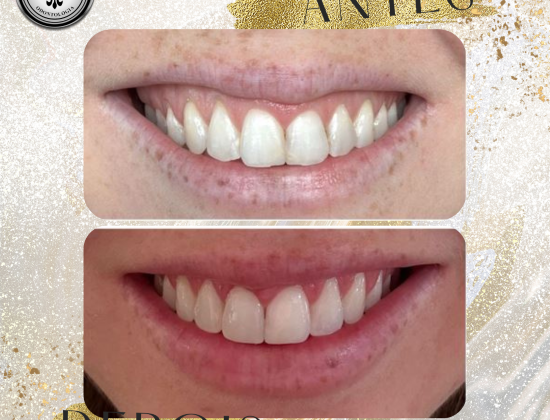 HARMONIZAÇÃO FACIAL