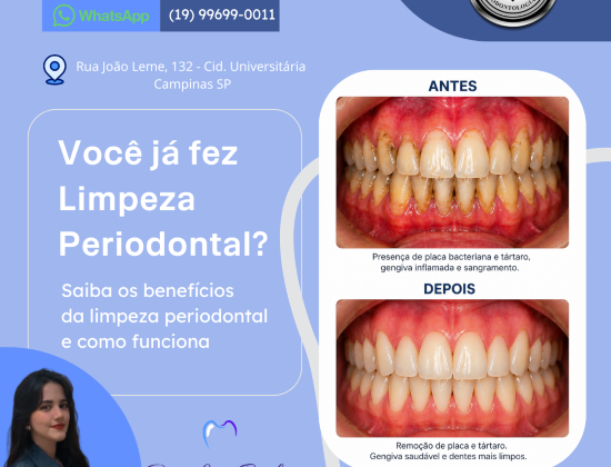 LIMPEZA PERIODONTAL