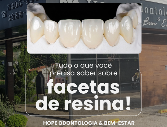 FACETAS DE RESINA