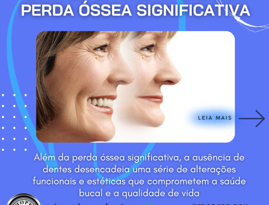 PERDA ÓSSEA SIGNIFICATIVA