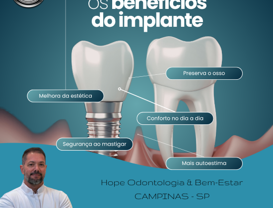 BENEFÍCIOS DO IMPLANTE BENEFÍCIOS DO IMPLANTE