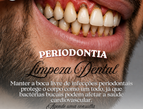 TRATAMENTO PERIODONTAL TRATAMENTO PERIODONTAL