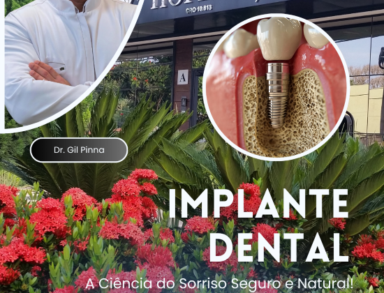 IMPLANTE DENTAL