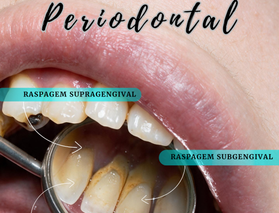 LIMPEZA PERIODONTAL