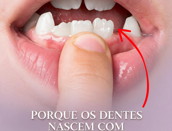 DENTES SERRILHADOS?