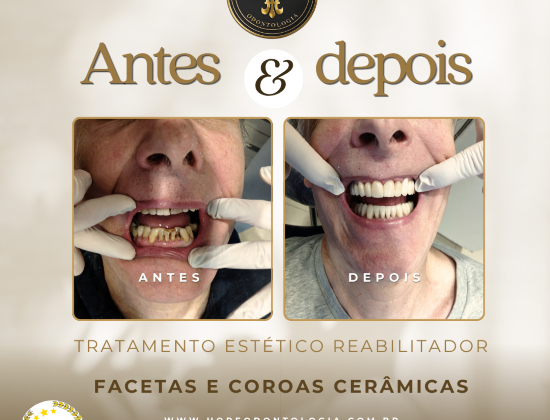 Sorriso Perfeito Criado e Desenhado na Hope