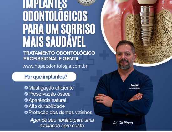 HOPE ODONTOLOGIA – IMPLANTES ODONTOLÓGICOS HOPE ODONTOLOGIA – IMPLANTES ODONTOLÓGICOS